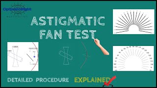 Astigmatic Fan Test Detailed Procedure and Principle Explained [upl. by Anileda]