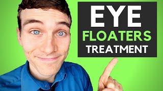 🔴How to Get Rid of Eye Floaters  3 Eye Floaters Treatments [upl. by Gnouh]