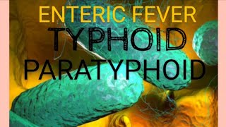 Enteric Fever  Typhoid fever  Paratyphoid Fever  Medicine  Microbiology [upl. by Marvin]