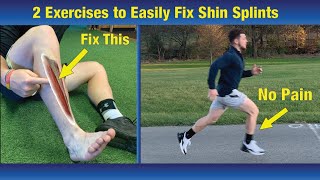 NO MORE Shin Splits  Run With Out Pain The Complete Cure [upl. by Roth643]