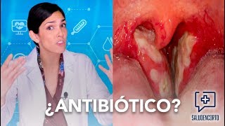 ¿Por qué NO tomar antibiótico  RESISTENCIA ANTIMICROBIANA Salud en Corto [upl. by Ohare]