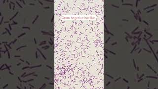 Gram negative rodsGram negative bacillusgramstaining microscopicbacteriology [upl. by Shiller]