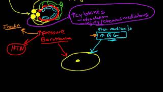 Pathophysiology of Diabetic Nephropathy [upl. by Asena]