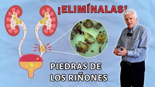 ¿Cómo EVITAR la formación y reaparición de CÁLCULOS RENALES  LITIASIS RENAL🪨 [upl. by Avlem]