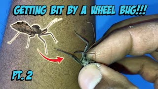 Getting Bit By A Wheel Bug Part 2 [upl. by Ingrim]