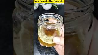 Amla Onion Methi amp Curry Leaves Oil for Extreme Hair Growth 🌿 [upl. by Mingche662]