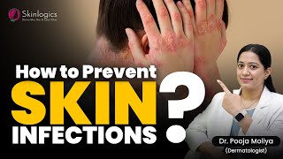 Symptoms of skin infection  How to prevent skin infection  Best Skin Doctor in Noida [upl. by Ettezil447]