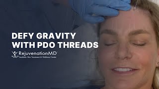 NonSurgical Brow Lift with PDO Threads [upl. by Ynttirb]