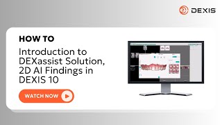 DEXIS™ Imaging Suite  Introduction to DEXassist Solution 2D AI Findings in DEXIS 10 [upl. by Aile938]