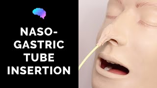 Nasogastric NG Tube Insertion  OSCE Guide  UKMLA  CPSA [upl. by Hibbs]