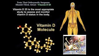 25 Vitamin D Tests Ortho Surgeons Think About Everything You Need To Know  Dr Nabil Ebraheim [upl. by Tirza]