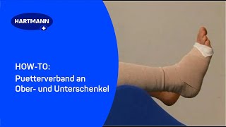 Puetterverband an Ober und Unterschenkel [upl. by Anibla]