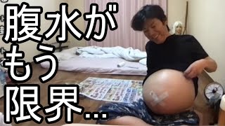 【金バエ】悲報 腹水が限界を超えている事を語る【肝不全 余命1年】 20240112 [upl. by Doersten]