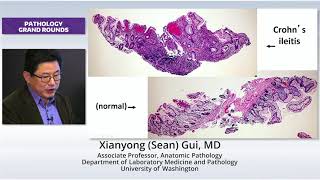 New Concepts in IBD Pathology [upl. by Anec]