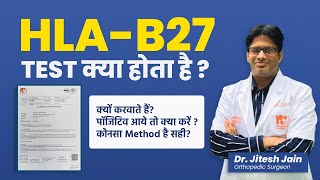 HLAB27 test क्या होता है Back Pain Test  Positive आये तो क्या करें  Dr Jitesh Jain [upl. by Suaeddaht]