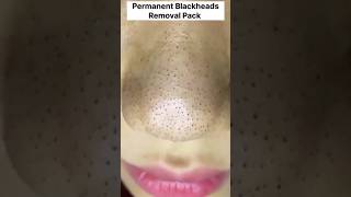 How to remove blackheads at home Permanent blackheads removal pack ytshorts viral diy shorts [upl. by Hares]