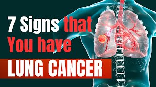 7 Early Warning Signs of Lung Cancer You Shouldnt Ignore  Warnings from the Lungs [upl. by Shaughn]