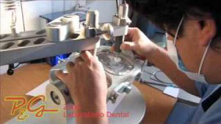 Laboratorio Dental PyG Zahn  Protesis dental zirconio [upl. by Meekah706]