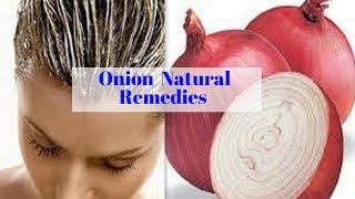 How To Get Rid OF Boils With Onion 7 Natural Remedies [upl. by Gruver376]