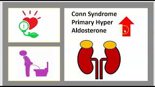 Metabolic Alkalosis Bartter Syndrome Gitelmans Liddles Conns Arthrogryposis Gordons Usmle Nclex [upl. by Gurolinick653]