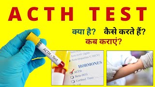 ACTH Test in Hindi  ACTH Test Procedure Preparation  Explained in Hindi [upl. by Ellasal]