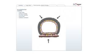 RCCornet  Physiotherapy for chronic obstructive pulmonary disease COPD [upl. by Earesed]