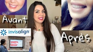 Mon Expérience INVISALIGN Maroc 2019😃 تجربتي معا تقويم الاسنان إنفيزالين [upl. by Yvaht769]