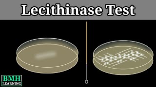 Lecithinase Test  Naglers Reaction  Clostridium Testing Method  Test For Clostridium Perfirenges [upl. by Nations]