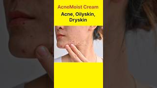 AcneMoist Cream Use in Hindi AcneaOilySkinskmedicine dryskin [upl. by Vite]