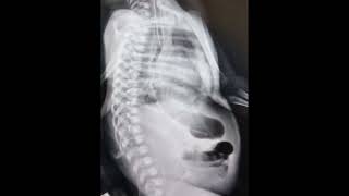 Newborn Xray l Abdominal Xray l Pause review comment nicu [upl. by Jedthus]