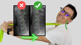 Best Exercise to Fix Loss of Neck Curve cervical lordosis or Military Neck  Dr Jon Saunders [upl. by Yanrahs]