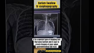 Barium Swallow procedure  Radiology success sigmarulessuccess shorts radiology medical xray [upl. by Gnaw]