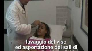 scuola europea medicina estetica  peeling [upl. by Koblick]