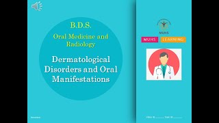 Dermatological Disorders and Oral Manifestations  Oral Medicine and Radiology  BDS  00845  PPT [upl. by Tandy]