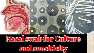 Nasal Swab for culture and sensitivity CS test [upl. by Nhabois493]