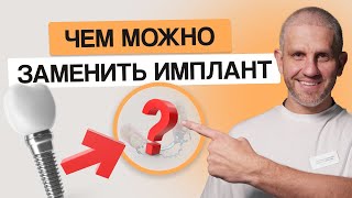 ВСЕГО 2 альтернативы Разбираю плюсы и минусы замены имплантации зубов [upl. by Janina]