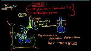 Pathophysiology of COPD [upl. by Jerusalem970]