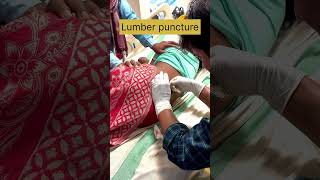 Lumber puncture procedure dayinthelife doctor medicine internship [upl. by Feune]