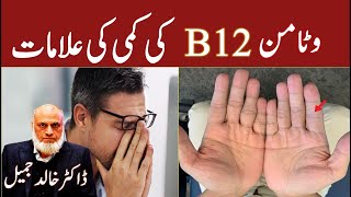 Vitamin B12 Deficiency and Symptoms  Lecture 204 [upl. by Kajdan560]