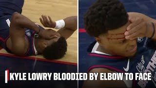 Kyle Lowry exits to locker room after elbow to the face in 76ers debut  NBA on ESPN [upl. by Renaxela]