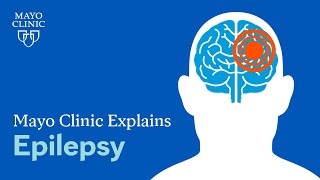 What is epilepsy A Mayo Clinic expert explains [upl. by Sheply]