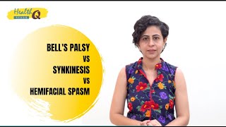 BELLS PALSY VS SYNKINESIS VS HEMIFACIAL SPASM [upl. by Phyl550]