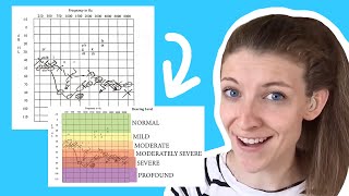 How to Read an Audiogram [upl. by Infeld830]