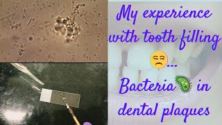 How Bacteria in dental plaques are seen under microscope [upl. by Ytte218]