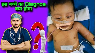 यह कौन सी बीमारी है  neonatal sepsis  severe sepsis in the baby  what is the treatment of sepsis [upl. by Navoj]