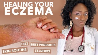 How to Treat ECZEMAAtopic Dermatitis Black Dark Skin Dry Flaky Skincare Routine Hyperpigmentation [upl. by Alonzo]