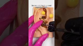 Ear wax removal 🦻🏻 asmr viral fyp shorts [upl. by Landa93]