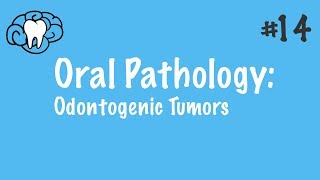 Oral Pathology  Odontogenic Tumors  INBDE ADAT [upl. by Piggy]