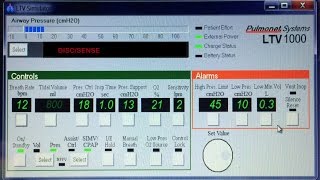 HOW TO CHANGE SETTINGS ON AN LTV VENTILATOR [upl. by Natalya]