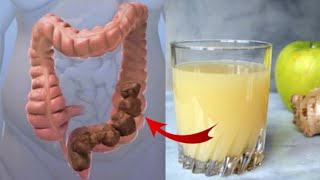 How to Cleanse Your Colon Quickly and safely at home [upl. by Ikcaj]